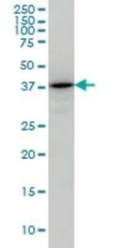 TSTA3 Antibody (2B9), Novus Biologicals 0.1 mg | Buy Online | Novus Biologicals | Fisher Scientific