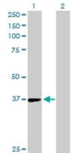 TSTA3 Antibody, Novus Biologicals 0.1 mg, Unconjugated:Antibodies, Polyclonal