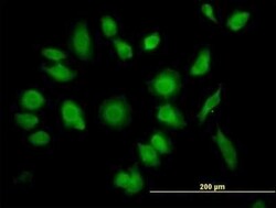 TTC1 Antibody, Novus Biologicals 0.05 mg | Buy Online | Novus Biologicals | Fisher Scientific
