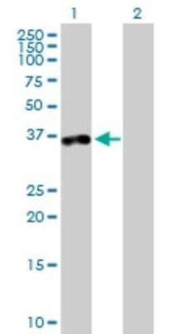 TTC1 Antibody, Novus Biologicals 0.05 mg | Buy Online | Novus Biologicals | Fisher Scientific