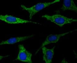 TTC11 Rabbit anti-Human, Clone: JE40-90, Novus Biologicals 100 &mu;l; Unconjugated:Antibodies,