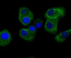 TTC11 Rabbit anti-Human, Clone: JE40-90, Novus Biologicals 100 &mu;l; Unconjugated:Antibodies,