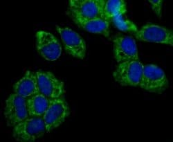 TTC11 Rabbit anti-Human, Clone: JE40-90, Novus Biologicals 100 &mu;l; Unconjugated:Antibodies,