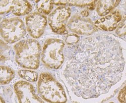 TTC11 Rabbit anti-Human, Clone: JE40-90, Novus Biologicals 100 &mu;l; Unconjugated:Antibodies,