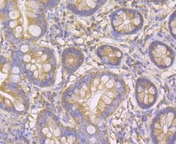 TTC11 Rabbit anti-Human, Clone: JE40-90, Novus Biologicals 100 &mu;l; Unconjugated:Antibodies,