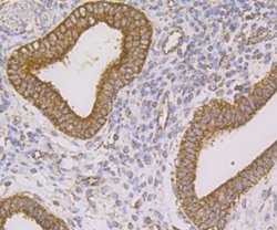 TTC11 Rabbit anti-Human, Clone: JE40-90, Novus Biologicals 100 &mu;l; Unconjugated:Antibodies,