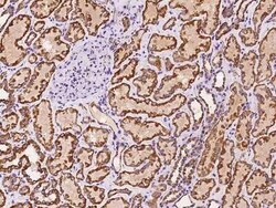 TTC11 Antibody, Novus Biologicals 50 &mu;g, Unconjugated:Antibodies, Polyclonal