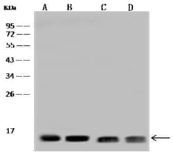 TTC11 Antibody, Novus Biologicals 50 &mu;g, Unconjugated:Antibodies, Polyclonal