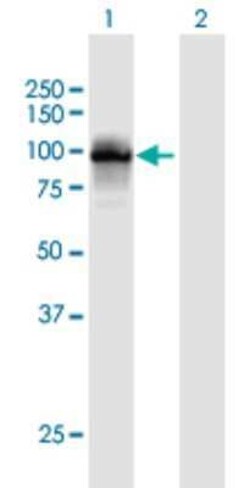 TTC15 Antibody, Novus Biologicals 50 &mu;g | Buy Online | Novus Biologicals | Fisher Scientific