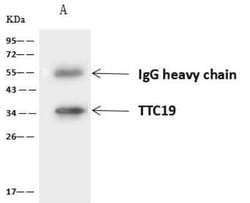 TTC19 Antibody, Novus Biologicals 50 &mu;g, Unconjugated:Antibodies, Polyclonal