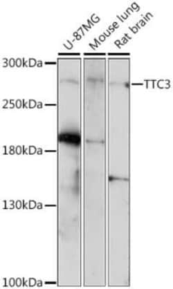 TTC3 Antibody - Azide and BSA Free, Novus Biologicals:Antibodies:Primary