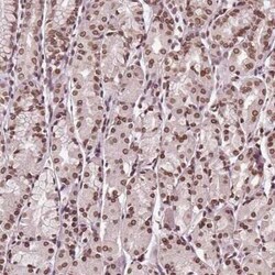 TTC39C Antibody, Novus Biologicals 25 &mu;L, Unconjugated:Antibodies, Polyclonal