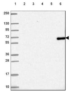 TTC39C Antibody, Novus Biologicals 25 &mu;L, Unconjugated:Antibodies, Polyclonal