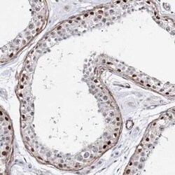TTC40 Antibody, Novus Biologicals:Antibodies:Primary Antibodies