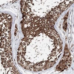 TTC40 Antibody, Novus Biologicals:Antibodies:Primary Antibodies