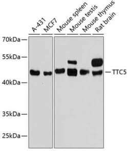 TTC5 Antibody - Azide and BSA Free, Novus Biologicals:Antibodies:Primary