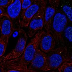 TTC6 Antibody, Novus Biologicals:Antibodies:Primary Antibodies