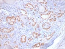 TTF-1 / NKX2-1 Mouse anti-Human, Mouse, Rat, Clone: rNX2.1/690, Novus Biologicals:Antibodies:Primary