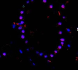 TTF-1/ NKX2-1 Antibody (8G7G3/1 + NX2.1/690), Novus Biologicals:Antibodies:Primary