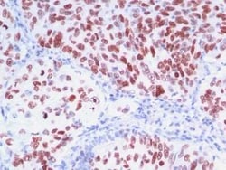 TTF-1/ NKX2-1 Antibody (8G7G3/1 + NX2.1/690), Novus Biologicals:Antibodies:Primary