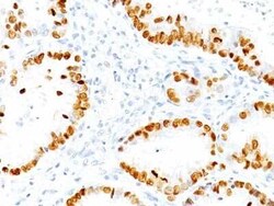 TTF-1/ NKX2-1 Antibody (NX2.1/690), Novus Biologicals:Antibodies:Primary