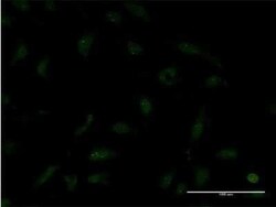 TTF2 Antibody (1E8), Novus Biologicals 0.1 mg | Buy Online | Novus Biologicals | Fisher Scientific