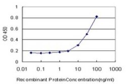 TTF2 Antibody (3D11), Novus Biologicals 0.1 mg | Buy Online | Novus Biologicals | Fisher Scientific