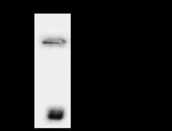 TTF2 Antibody, Novus Biologicals 50 &mu;g, Unconjugated:Antibodies, Polyclonal