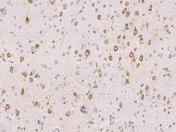 TTK Antibody, Novus Biologicals 50 &mu;g, Unconjugated:Antibodies, Polyclonal