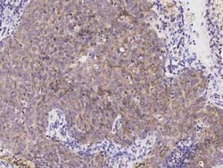 TTK Antibody, Novus Biologicals 50 &mu;g, Unconjugated:Antibodies, Polyclonal