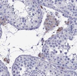 TTLL13 Antibody, Novus Biologicals:Antibodies:Primary Antibodies