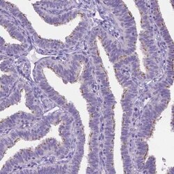 TTLL6 Antibody, Novus Biologicals 25 &mu;L, Unconjugated:Antibodies, Polyclonal
