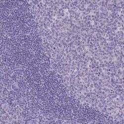 TTLL6 Antibody, Novus Biologicals 25 &mu;L, Unconjugated:Antibodies, Polyclonal