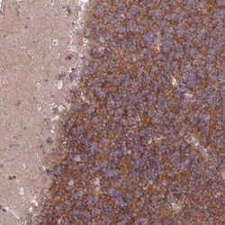 TTLL7 Antibody, Novus Biologicals:Antibodies:Primary Antibodies