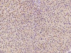 TTMP Antibody, Novus Biologicals:Antibodies:Primary Antibodies