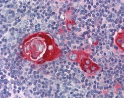 TTP Antibody, Novus Biologicals 100 &mu;L; Unconjugated:Antibodies, Polyclonal
