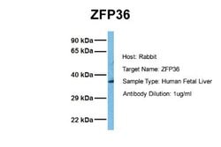TTP Antibody, Novus Biologicals 100 &mu;L; Unconjugated:Antibodies, Polyclonal