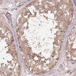Tubulin alpha-1B Antibody, Novus Biologicals:Antibodies:Primary Antibodies