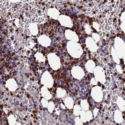 TUBAL3 Antibody, Novus Biologicals 25 &mu;L | Buy Online | Novus Biologicals | Fisher Scientific