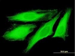 TUBB4Q Antibody, Novus Biologicals 50 &mu;g | Buy Online | Novus Biologicals | Fisher Scientific