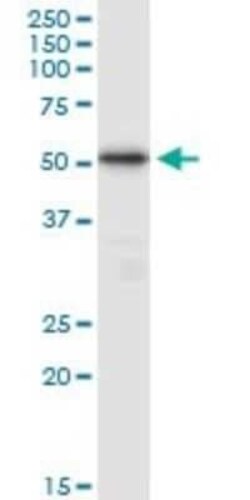 TUBB4Q Antibody, Novus Biologicals 50 &mu;g | Buy Online | Novus Biologicals | Fisher Scientific