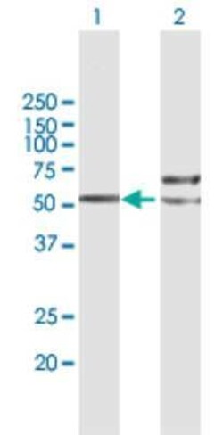 TUBB4Q Antibody, Novus Biologicals 50 &mu;g | Buy Online | Novus Biologicals | Fisher Scientific