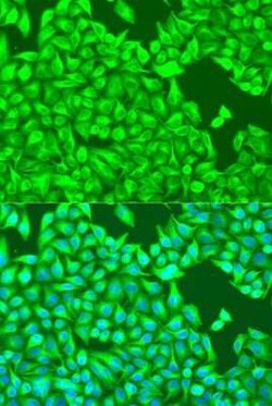 TUBB8 Antibody - BSA Free, Novus Biologicals 20 &mu;g | Buy Online | Novus Biologicals | Fisher Scientific