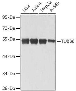 TUBB8 Antibody - BSA Free, Novus Biologicals 20 &mu;g | Buy Online | Novus Biologicals | Fisher Scientific