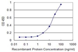 TUBGCP5 Antibody (2H5), Novus Biologicals 0.1 mg | Buy Online | Novus Biologicals | Fisher Scientific