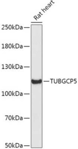 TUBGCP5 Antibody - Azide and BSA Free, Novus Biologicals 0.02 mL; Unconjugated:Antibodies,