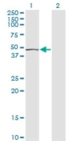 TUFM Antibody (1A2), Novus Biologicals 0.1 mg | Buy Online | Novus Biologicals | Fisher Scientific