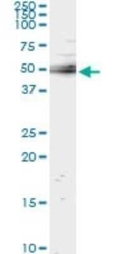 TULA/STS-2 Antibody (4D2), Novus Biologicals 0.1 mg | Buy Online | Novus Biologicals | Fisher Scientific