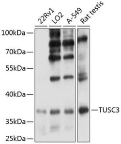 TUSC3 Antibody - Azide and BSA Free, Novus Biologicals:Antibodies:Primary