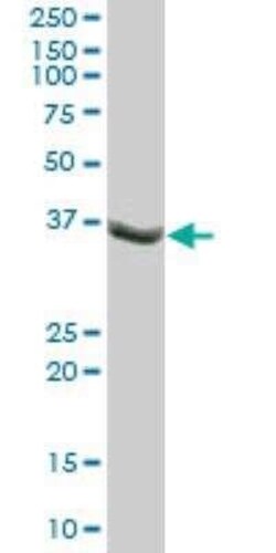 TUSC4 Antibody, Novus Biologicals 0.05 mg | Buy Online | Novus Biologicals | Fisher Scientific